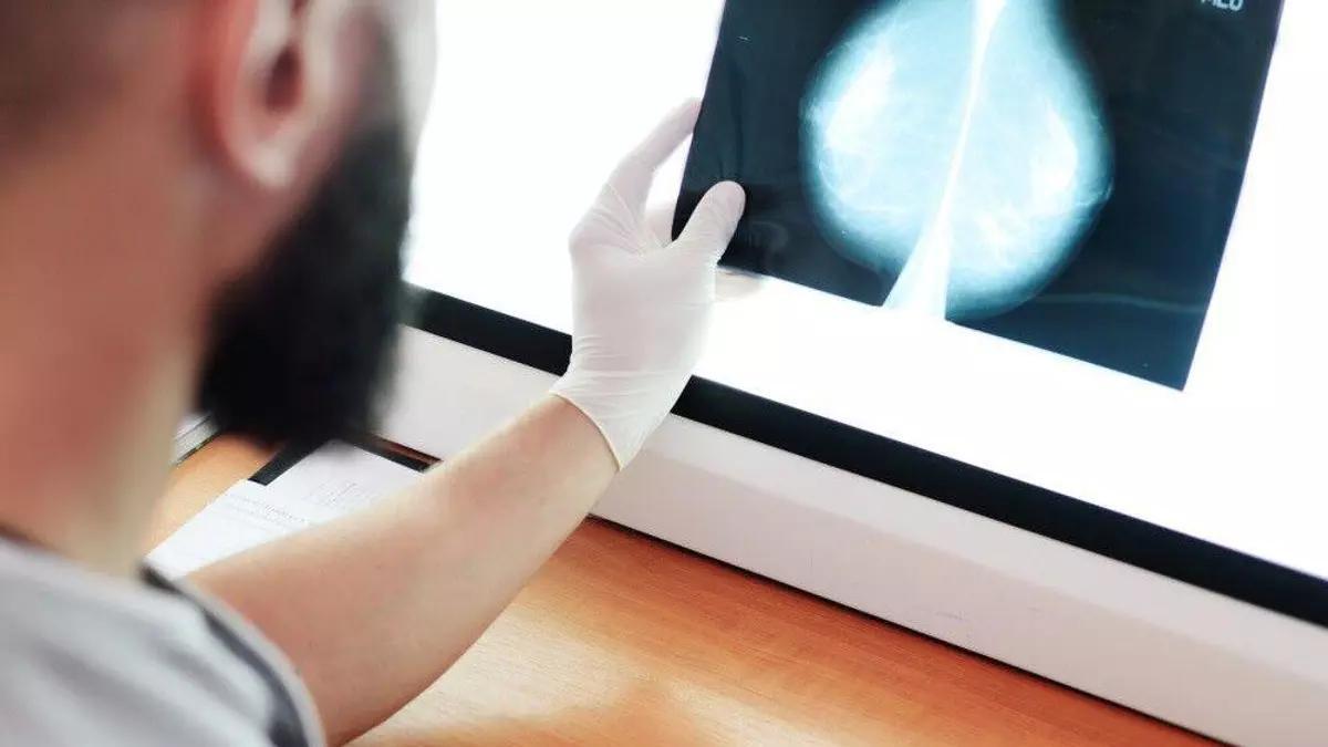 NTT Data y su problema de reputación por los cribados de cáncer de mama